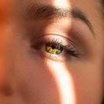 Should I have IPL to Treat Acne?