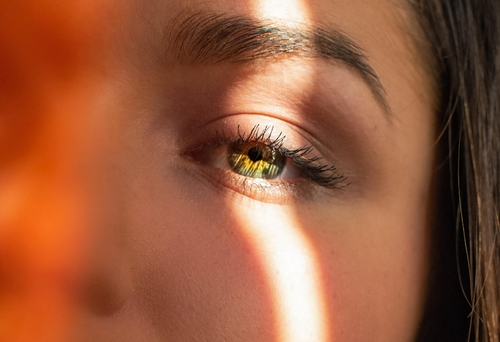 Should I have IPL to Treat Acne?