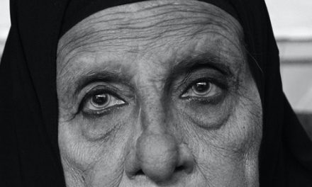 How Can I Get Rid of Eyebags!