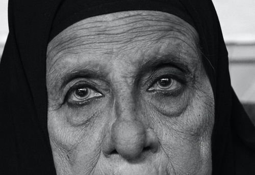 How Can I Get Rid of Eyebags!